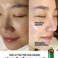 Siêu Vi Tảo Uống 